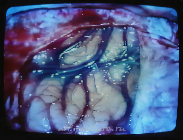 Animation (ism) or Doctor’s Case., 0, Видеоинсталляция,   Собственность автора.Видеоинсталляция на ежегодной выставке Центра современного искусства Сороса-Москва "NewMedia Topia", Центральный Дом художника, Москва